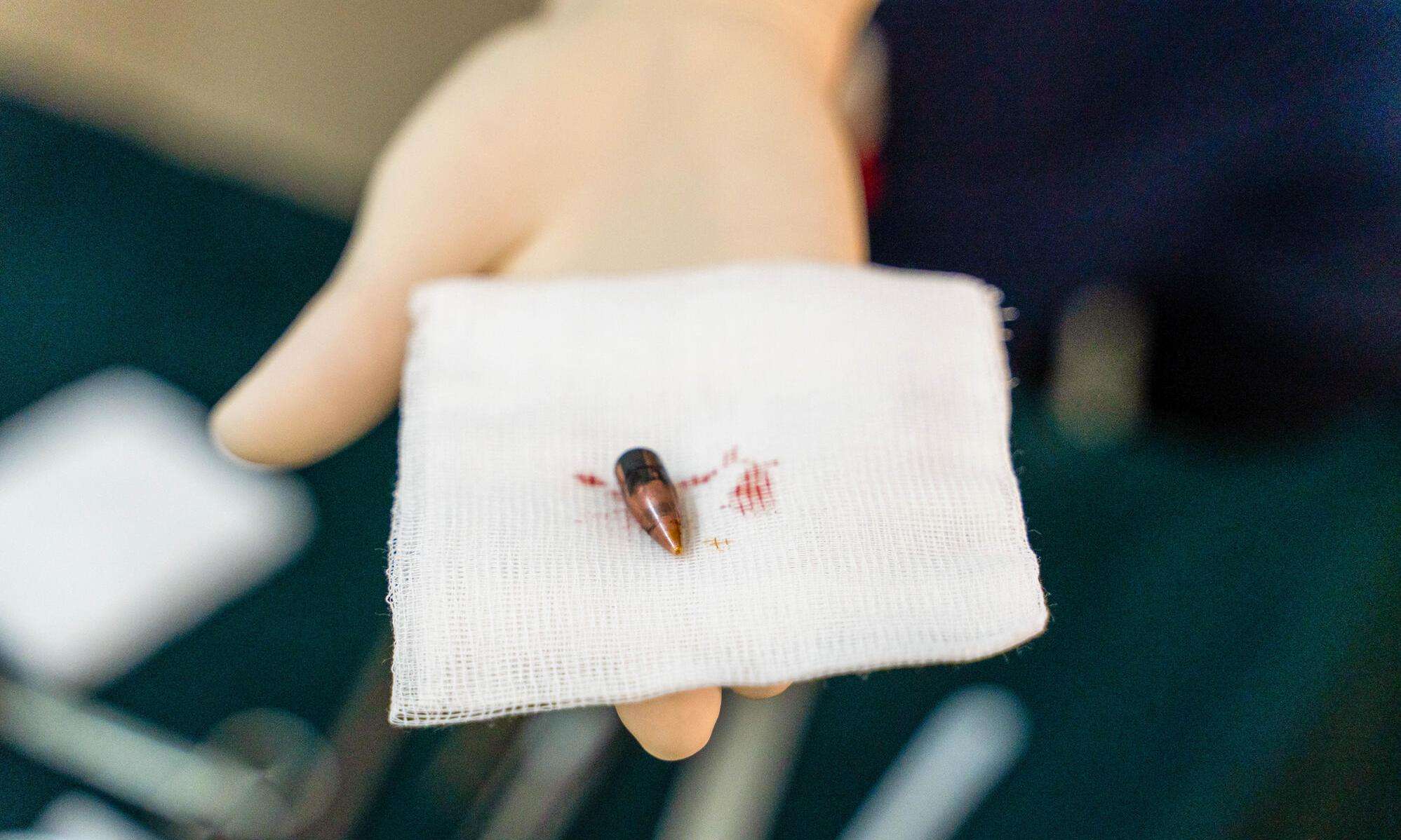 A hand holding a bullet extracted from a patient in Sudan.