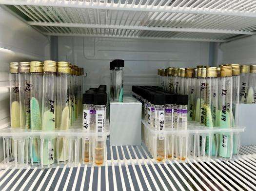 The mycobacterium tuberculosis culture is tested against different antibiotics in the laboratory.