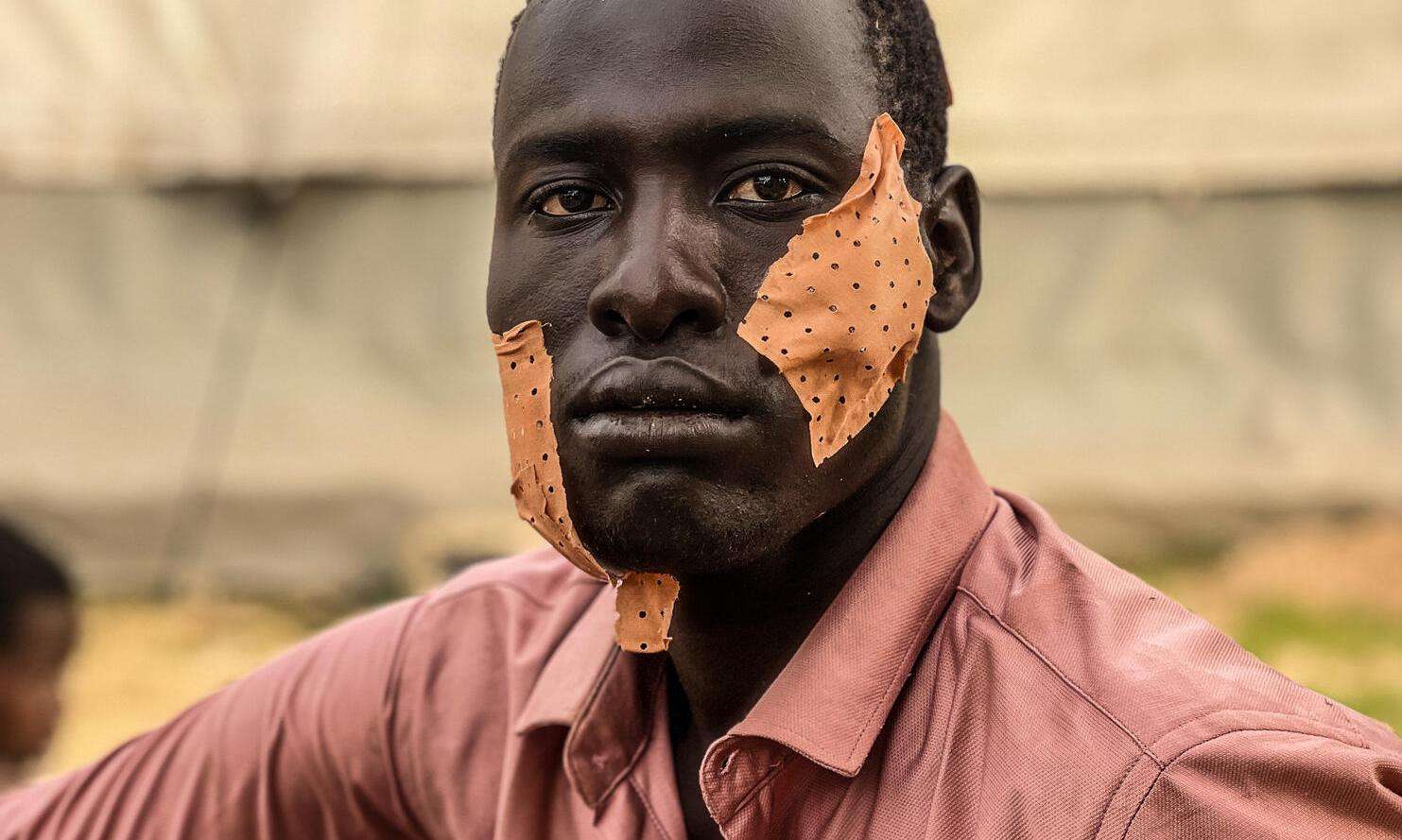 Young man from Sudan with bandaged wound on cheek after being treated by MSF aid workers in Chad