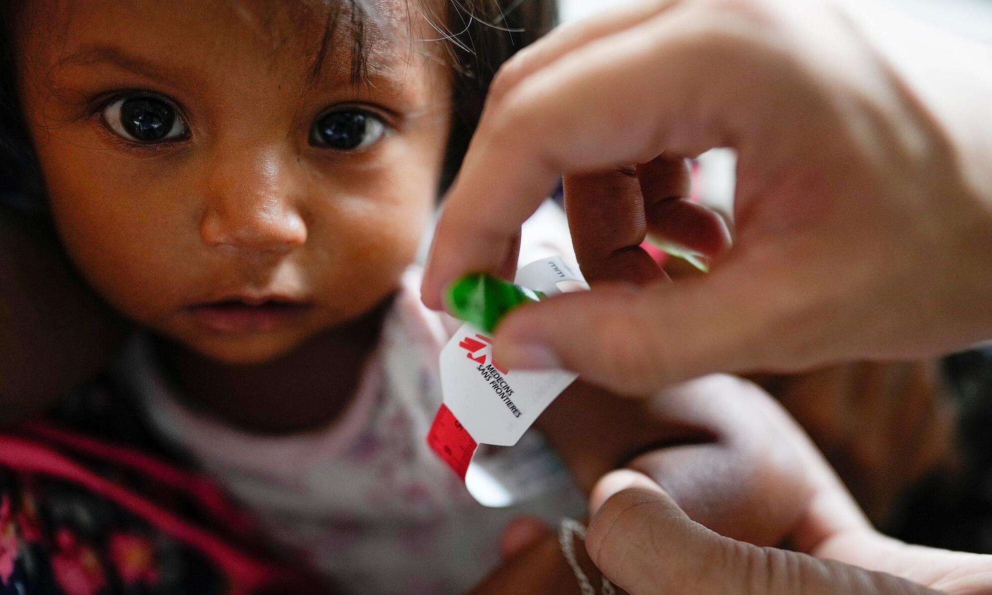 An indigenous child receives medical care from MSF teams in Venezuela.