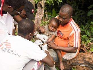 Monkey pox in Mbaiki