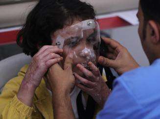A doctor holds a clear 3D-printed mask up to the face of a young girl with facial scars in Gaza, Palestine.
